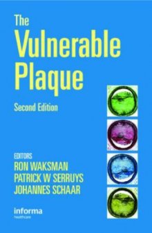 The Vulnerable Plaque, Second Edition