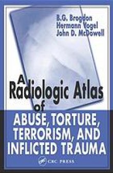A radiologic atlas of abuse, torture, terrorism, and inflicted trauma