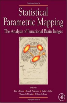 Statistical parametric mapping: the analysis of funtional brain images