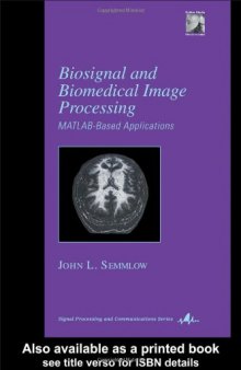 Biosignal and medical image processing. MATLAB based applications