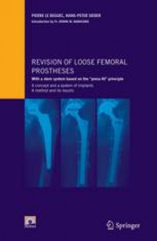 Revision of Loose Femoral Prostheses: With a Stem System Based on the “Press-Fit” Principle: A Concept and a System of Implants: A Method and Its Results