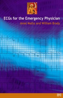 ECGs for the emergency physician