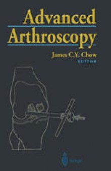 Advanced Arthroscopy