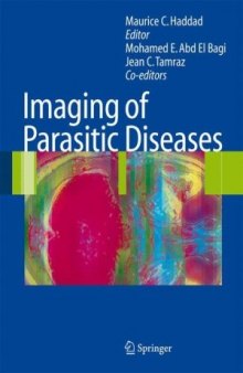 Imaging of parasitic diseases: with 28 tables