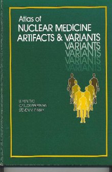Atlas of Nuclear Medicine Artifacts and Variants 