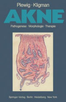 Akne: Pathogenese Morphologie Therapie