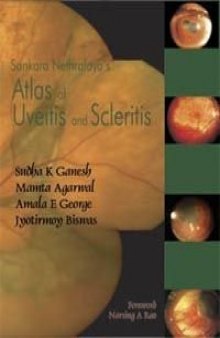Atlas of Uvetis and Scleritis