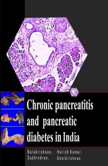 Chronic pancreatitis and pancreatic diabetes in India