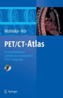 PET/CT-Atlas: Ein interdisziplinärer Leitfaden der onkologischen PET/CT-Diagnostik