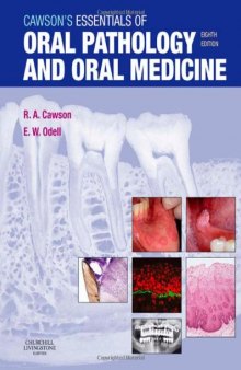 Cawson's Essentials of Oral Pathology and Oral Medicine, 8e