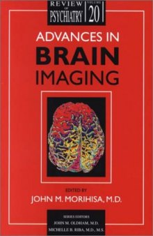 Advances in Brain Imaging