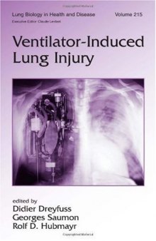 Lung Biology in Health & Disease Volume 215 Ventilator-Induced Lung Injury