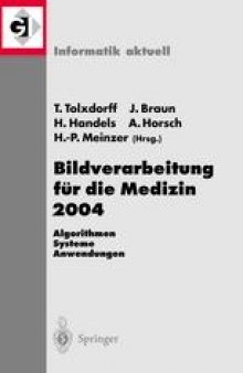 Bildverarbeitung für die Medizin 2004: Algorithmen — Systeme — Anwendungen