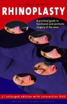 Rhinoplasty: A practical guide to functional and aesthetic surgery of the nose, 3rd Edition