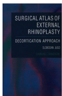 Surgical atlas of external rhinoplasty : decortication approach