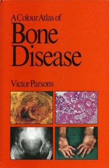 A Colour Atlas of Bone Disease (Wolfe Medical Atlases)