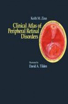 Clinical Atlas of Peripheral Retinal Disorders