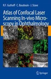Atlas of Confocal Laser Scanning In-vivo Microscopy in Ophthalmology: Principles and Applications in Diagnostic and Therapeutic Ophthalmology