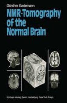 NMR-Tomography of the Normal Brain