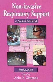 Non-invasive respiratory support: a practical handbook