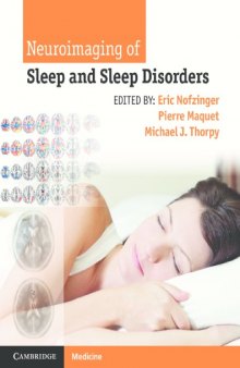 Neuroimaging of Sleep and Sleep Disorders