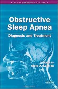 Obstructive Sleep Apnea. Diagnosis and Treatment