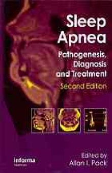 Sleep apnea : pathogenesis, diagnosis, and treatment
