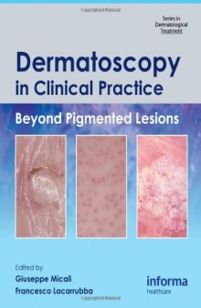 Dermatoscopy in Clinical Practice: Beyond Pigmented Lesions (Series in Dermatological Treatment)