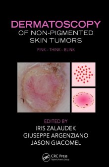 Dermatoscopy of Non-Pigmented Skin Tumors : Pink - Think - Blink.