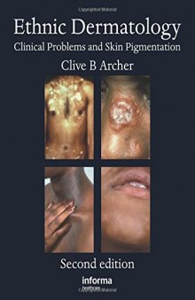 Ethnic dermatology : clinical problems and pigmented skin