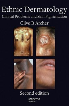 Ethnic Dermatology: Clinical Problems and Skin Pigmentation