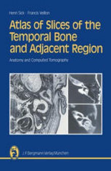 Atlas of Slices of the Temporal Bone and Adjacent Region: Anatomy and Computed Tomography Horizontal, Frontal, Sagittal Sections