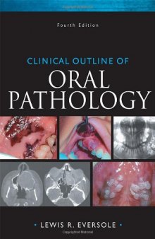Clinical Outline of Oral Pathology: Diagnosis and Treatment  