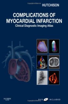Complications of Myocardial Infarction: Clinical Diagnostic Imaging Atlas with DVD (Cardiovascular Emergencies: Atlas and Multimedia)  