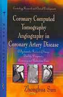 Coronary Computed Tomography Angiography in Coronary Artery Disease: A Systematic Review of Image Quality, Diagnostic Accuracy and Radiation Dose