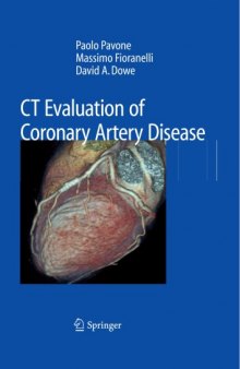 CT Evaluation of Coronary Artery Disease