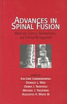 Advances in spinal fusion : molecular science, biomechanics, and clinical management