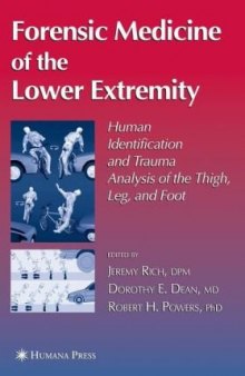 Forensic medicine of the lower extremity: human identification and trauma analysis of the thigh, leg, and foot
