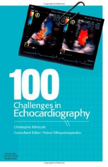 100 Challenges in Echocardiography  