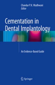 Cementation in Dental Implantology: An Evidence-Based Guide