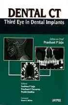 Dental CT: Third Eye in Dental Implants