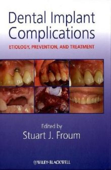 Dental Implant Complications: Etiology, Prevention, and Treatment