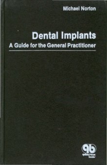 Dental Implants: A Guide for the General Practitioner