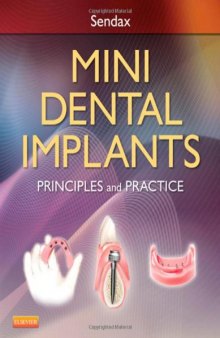 Mini Dental Implants: Principles and Practice, 1e