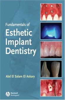 Fundamentals of Esthetic Implant Dentistry, Second Edition