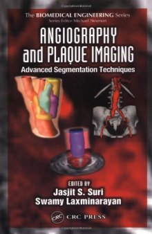 Angiography and plaque imaging: advanced segmentation techniques  