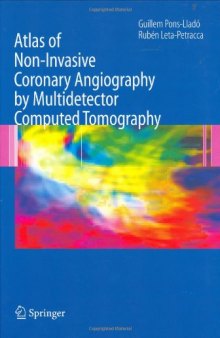 Atlas of Non-Invasive Coronary Angiography by Multidetector Computed Tomography (Developments in Cardiovascular Medicine)  