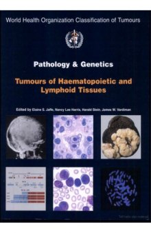 Pathology and Genetics: Tumours of Haematopoietic and Lymphoid Tissues (World Health Organization Classification of Tumours)