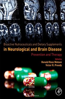 Bioactive nutriceuticals and food supplements in neurological and brain