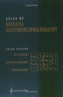 Atlas of Neonatal Electroencephalography  